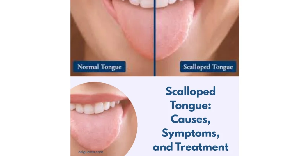 Scalloped Tongue Causes, Symptoms, and Treatment