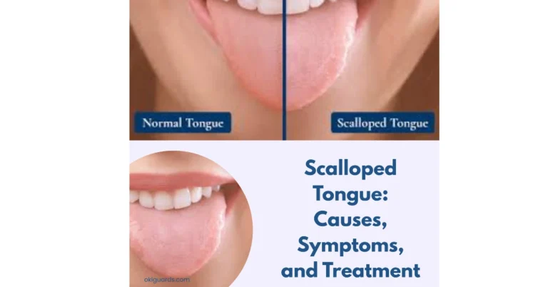 Scalloped Tongue Causes, Symptoms, and Treatment