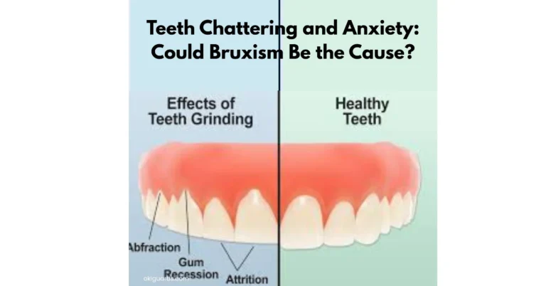 Teeth Chattering and Anxiety Could Bruxism Be the Cause