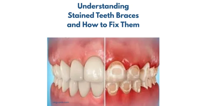 Understanding Stained Teeth Braces and How to Fix Them