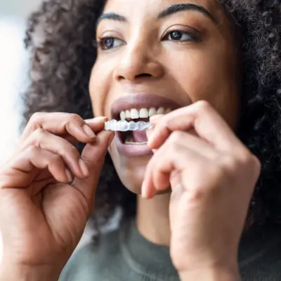 OKI Custom mouth guards for grinding