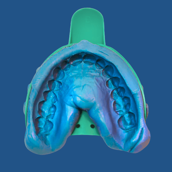 NIght Guard teeth impression