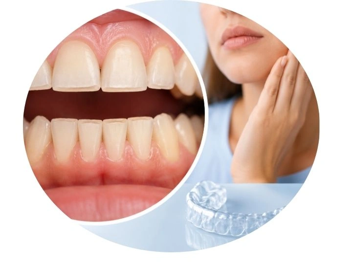 flat teeth from grinding